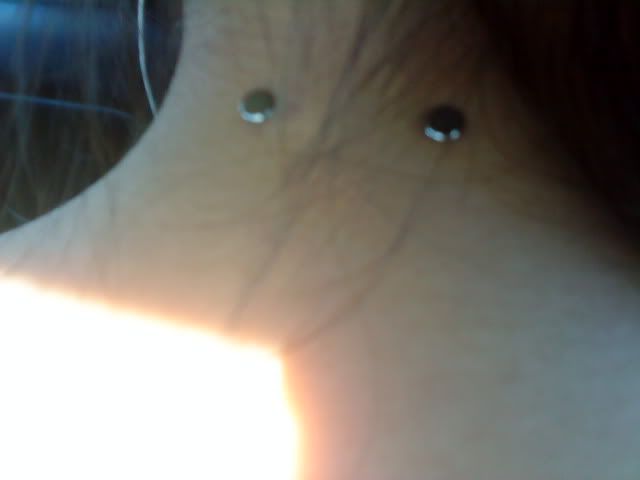 piercing infection. helix piercing infection. my